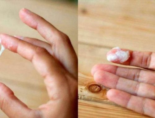 Зеленуваті виділення без запаху і болю у жінок причини та дії