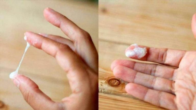 Зеленуваті виділення без запаху і болю у жінок причини та дії