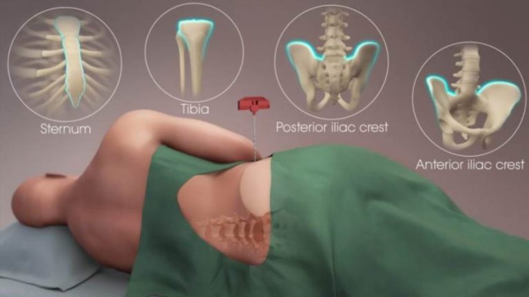 Де в тілі людини ховається кістковий мозок