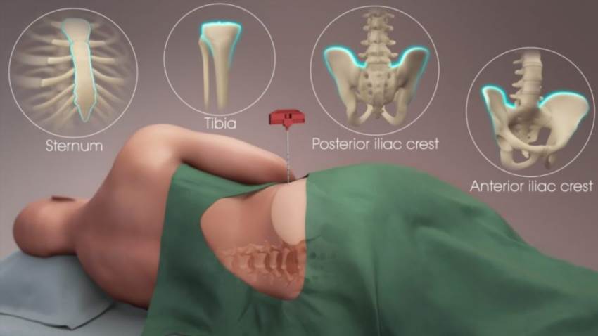 Де в тілі людини ховається кістковий мозок