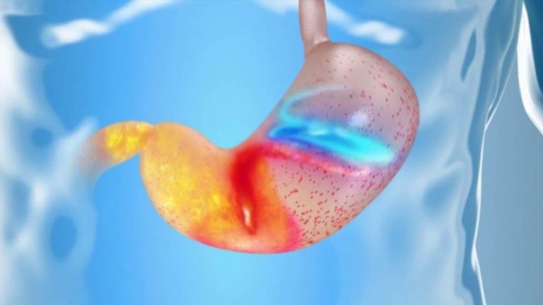 Коли Мотиліум стає справжнім порятунком для шлунка