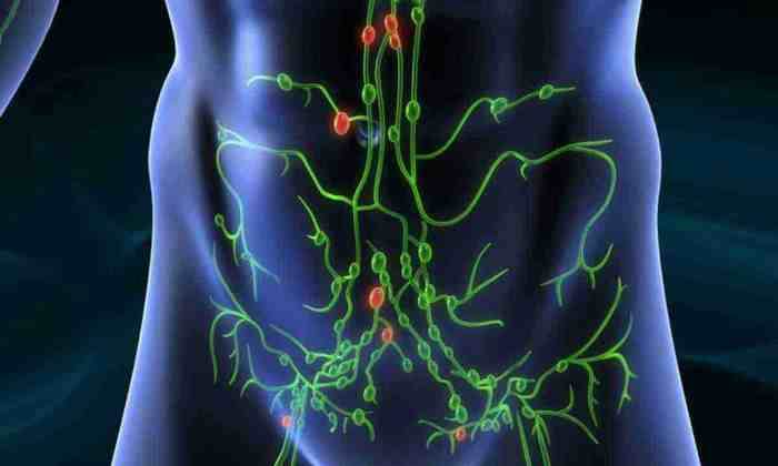 Лімфовузли в паху збільшилися – що це означає і коли бити на сполох